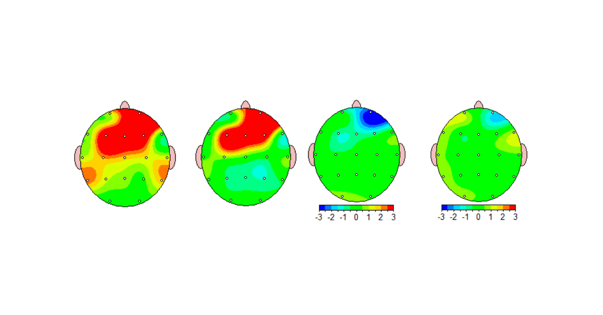 aires tech eeg brain scan the wave emf blog